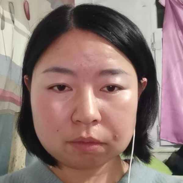 黑龙江残疾人女孩真诚相亲找对象，宜宾相亲网